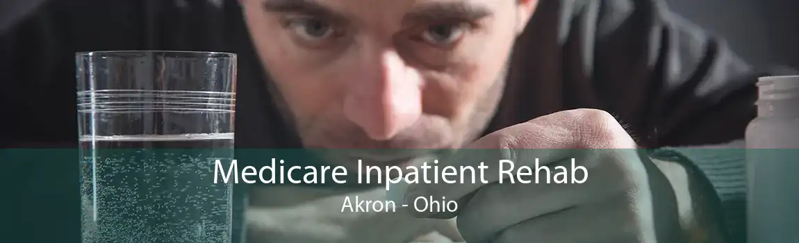Medicare Inpatient Rehab Akron - Ohio