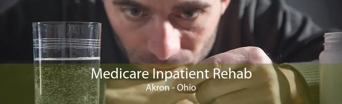 Medicare Inpatient Rehab Akron - Ohio